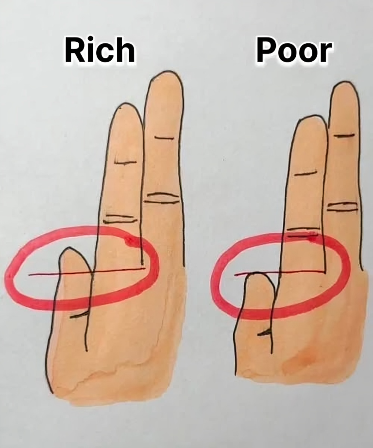 Your Fingers Could Reveal Whether You’re Rich or Poor