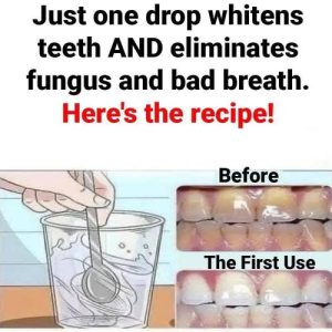 🦷 Just one drop whitens teeth, eliminates fungus, and fights bad breath