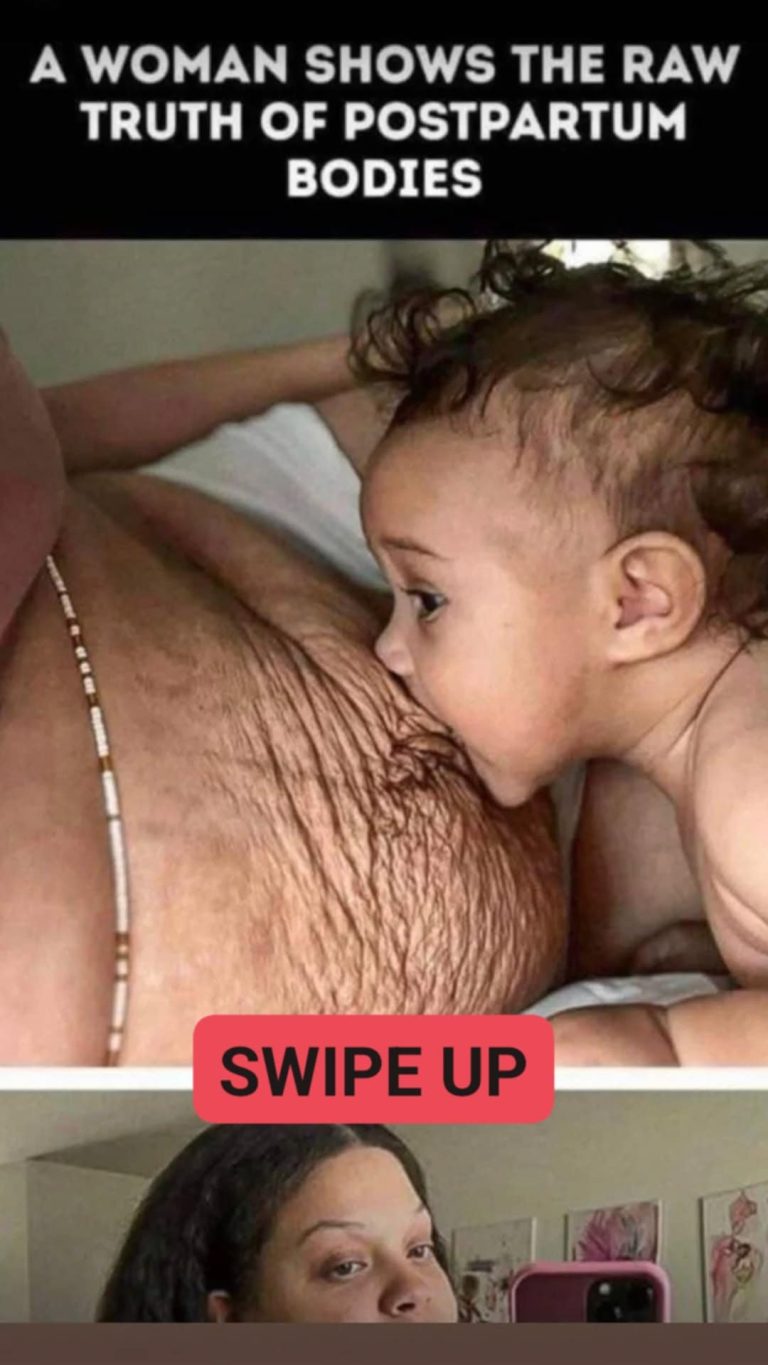 HealthMoms Get Brutally Honest About Post-Baby Bodies — And Fans Are Cheering