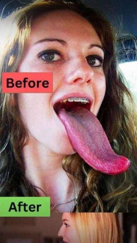 White Tongue Explained: Causes, Care, and Safe Remedies for a Healthy Mouth